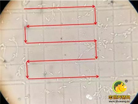 手机竟可以观察精子？原来全靠它......