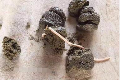 你的电子游艺网站
如何做卫生防疫？必须要有健全的防疫制度！