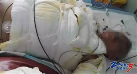 饲料发酵遇高温炸了电子游艺网站
 咱养猪人伤不起