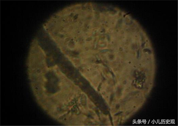 然后将采回来的样本放在显微镜下比较观察，看看哪些比较活跃，如今农村兽医越来越少了，很少有人想要做这一行。