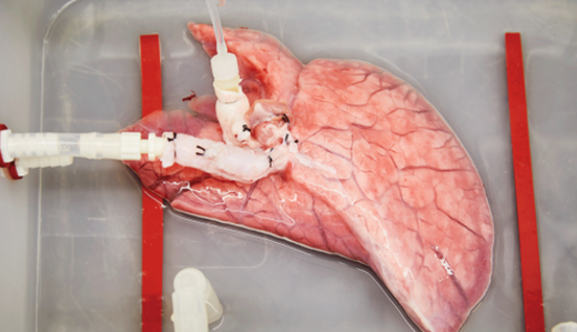 移植缺口巨大:如果把老鼠和猪的器官移到人身上呢？