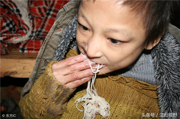 与猪争食生吞鸡鸭，一天最多咬死7只，怪病男孩四处寻医有望康复!